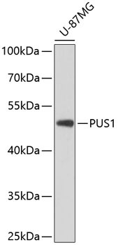 PUS1 Rabbit Polyclonal Antibody