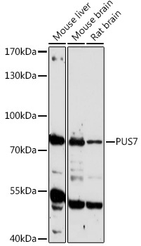 PUS7 Rabbit Polyclonal Antibody