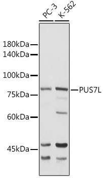 PUS7L Rabbit Polyclonal Antibody