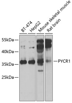 PYCR1 Rabbit Polyclonal Antibody