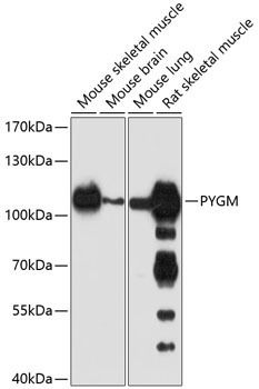 PYGM Rabbit Polyclonal Antibody