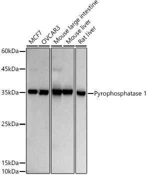 Pyrophosphatase 1 Rabbit Monoclonal Antibody