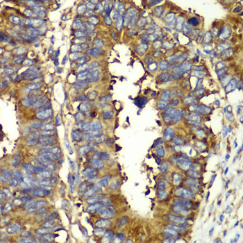 QARS Rabbit Polyclonal Antibody - Image 2