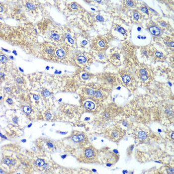 QARS Rabbit Polyclonal Antibody - Image 3