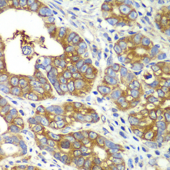 QARS Rabbit Polyclonal Antibody - Image 4
