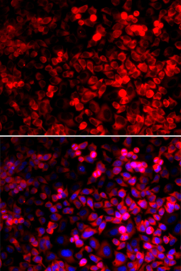 QARS Rabbit Polyclonal Antibody - Image 5