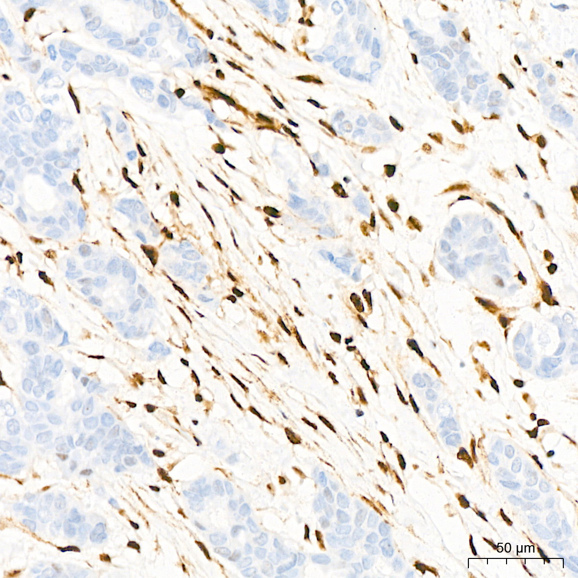 QKI Rabbit Monoclonal Antibody - Image 3