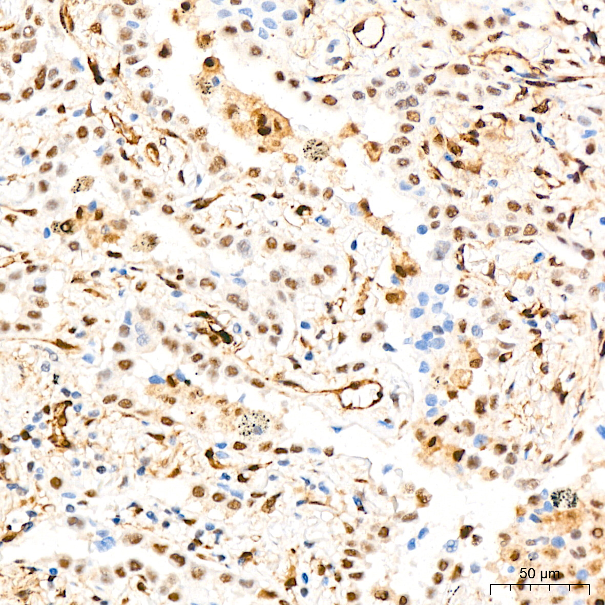 QKI Rabbit Monoclonal Antibody - Image 4
