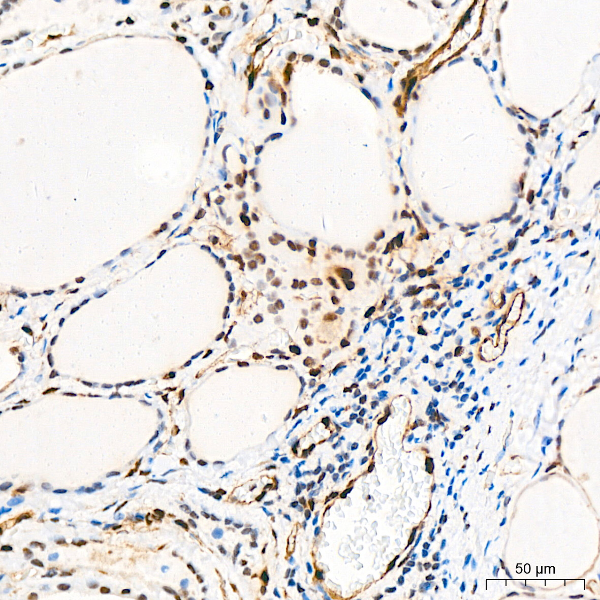 QKI Rabbit Monoclonal Antibody - Image 5