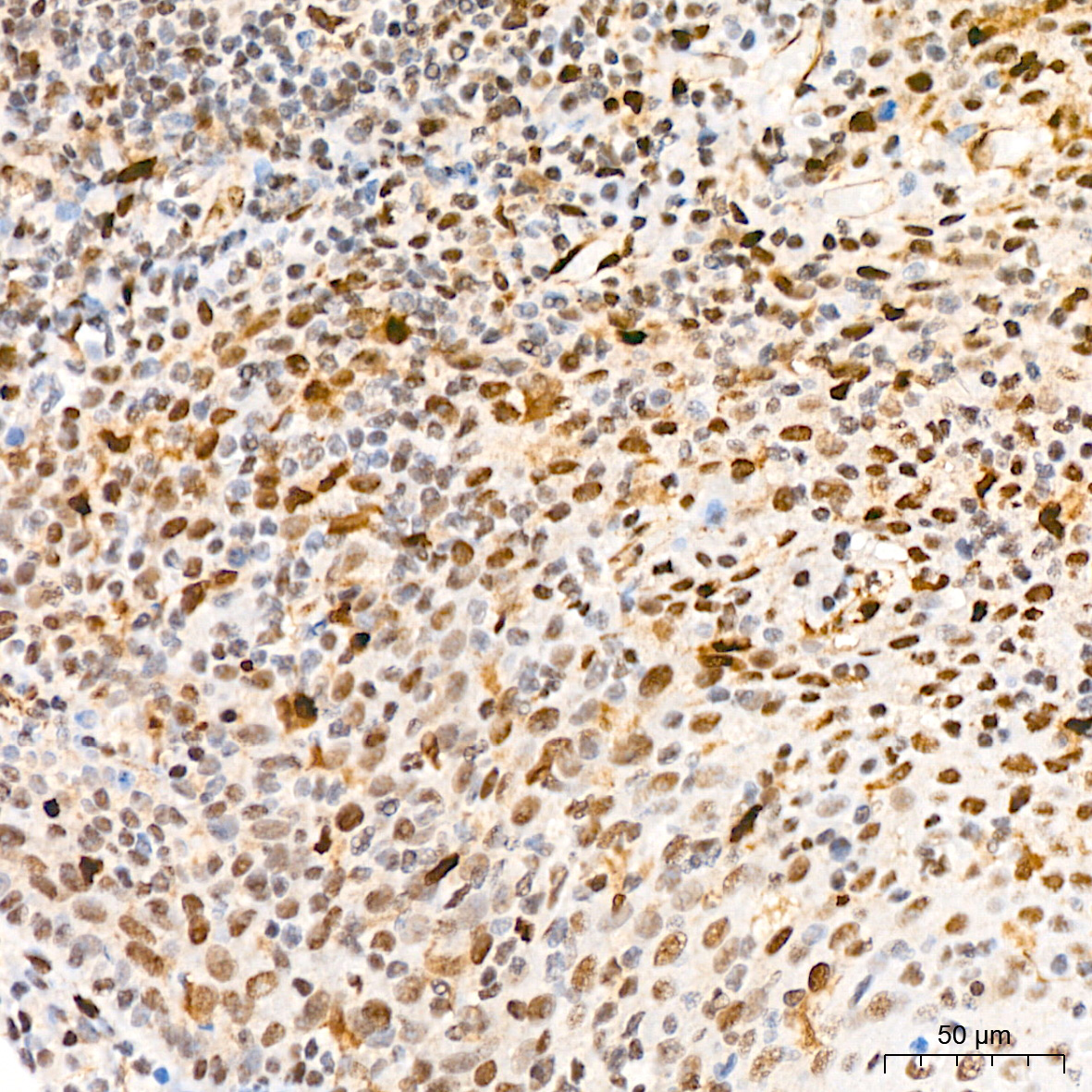 QKI Rabbit Monoclonal Antibody - Image 6