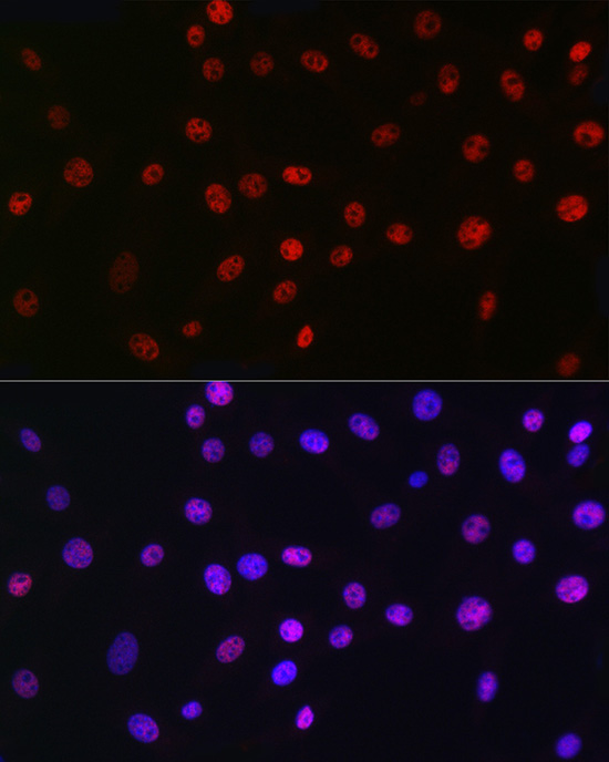 QKI Rabbit Monoclonal Antibody - Image 10