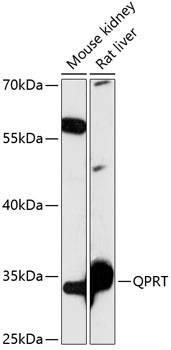 QPRT Rabbit Polyclonal Antibody