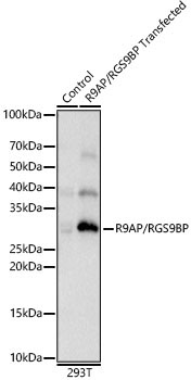R9AP/RGS9BP Rabbit Polyclonal Antibody