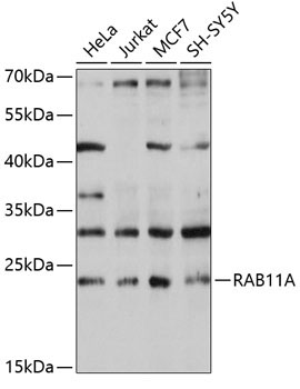 RAB11A Rabbit Polyclonal Antibody