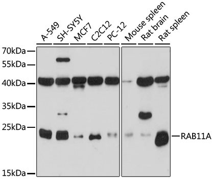 RAB11A Rabbit Polyclonal Antibody