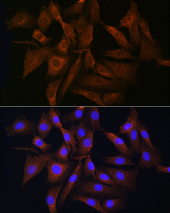 RAB11A/RAB11B Rabbit Polyclonal Antibody - Image 2