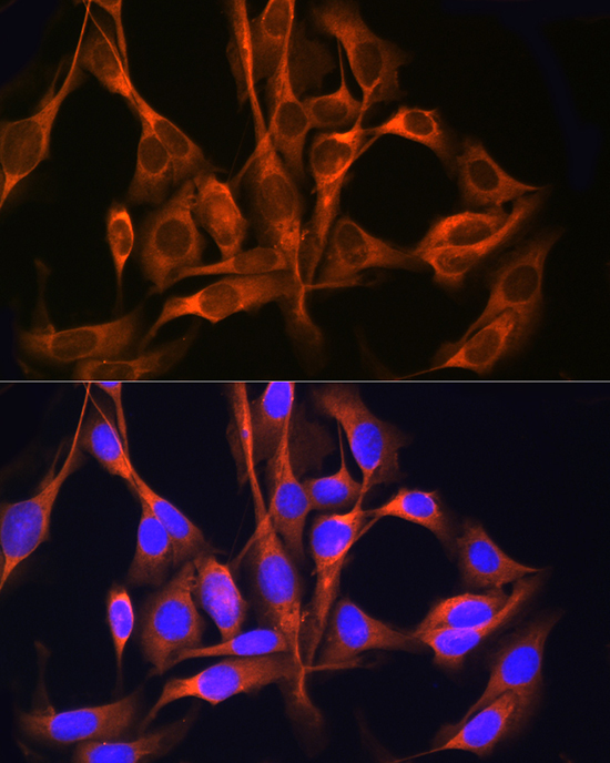 RAB11A/RAB11B Rabbit Polyclonal Antibody - Image 3