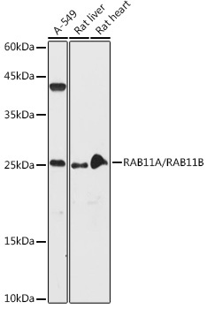 RAB11A/RAB11B Rabbit Polyclonal Antibody - Image 4