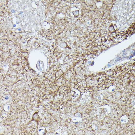 RAB11A/RAB11B Rabbit Polyclonal Antibody - Image 5