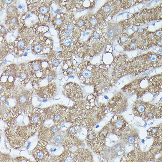 RAB11A/RAB11B Rabbit Polyclonal Antibody - Image 6