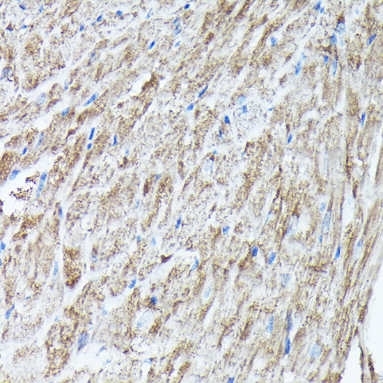 RAB11A/RAB11B Rabbit Polyclonal Antibody - Image 7