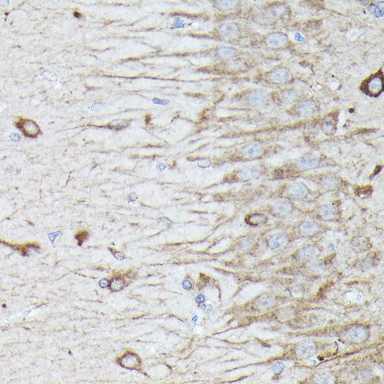 RAB11A/RAB11B Rabbit Polyclonal Antibody - Image 8