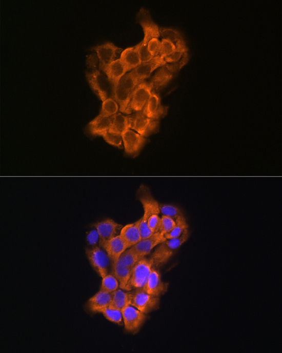 RAB11A/RAB11B Rabbit Polyclonal Antibody - Image 9