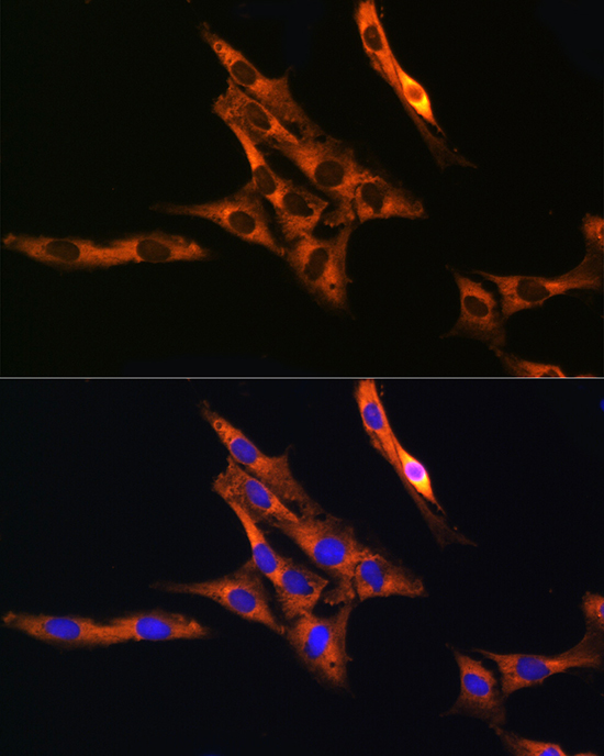 RAB11A/RAB11B Rabbit Polyclonal Antibody - Image 10