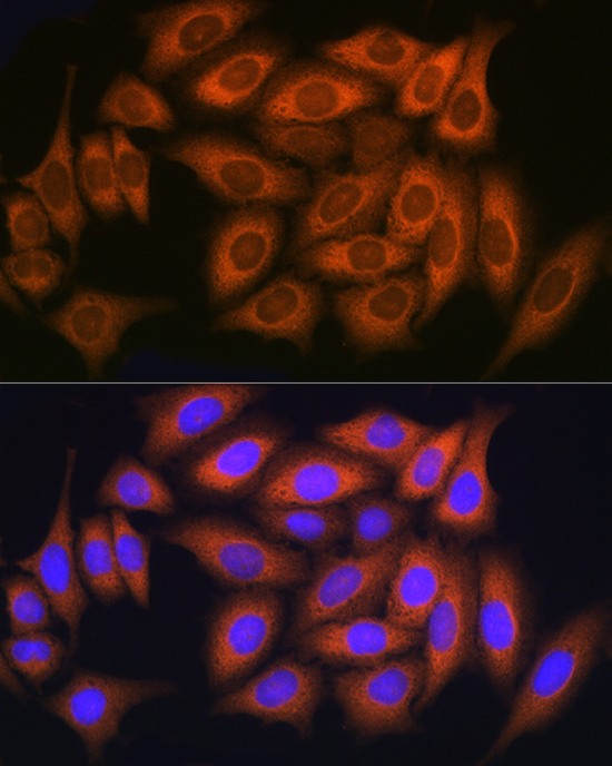 RAB11A/RAB11B Rabbit Polyclonal Antibody - Image 11