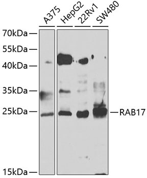 RAB17 Rabbit Polyclonal Antibody