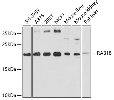 RAB18 Rabbit Polyclonal Antibody