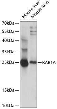RAB1A Rabbit Polyclonal Antibody