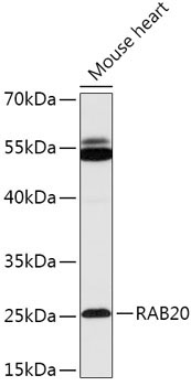 RAB20 Rabbit Polyclonal Antibody
