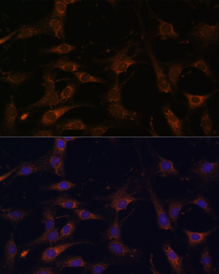 RAB21 Rabbit Polyclonal Antibody - Image 2