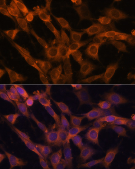 RAB21 Rabbit Polyclonal Antibody - Image 3