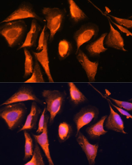 RAB21 Rabbit Polyclonal Antibody - Image 4