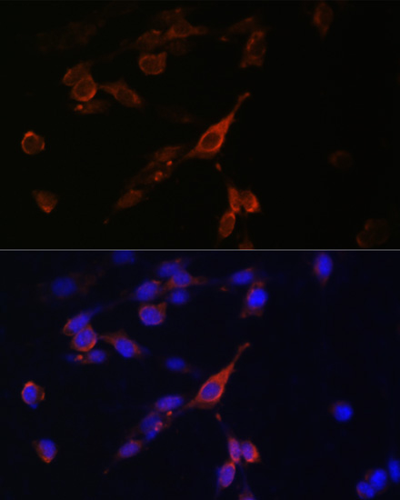 RAB21 Rabbit Polyclonal Antibody - Image 5