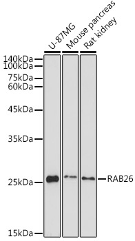 RAB26 Rabbit Polyclonal Antibody
