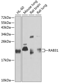 RAB31 Rabbit Polyclonal Antibody