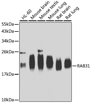 RAB31 Rabbit Polyclonal Antibody