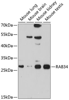 RAB34 Rabbit Polyclonal Antibody
