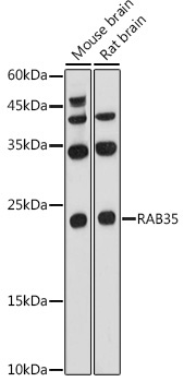 RAB35 Rabbit Polyclonal Antibody