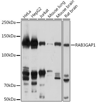 RAB3GAP1 Rabbit Polyclonal Antibody