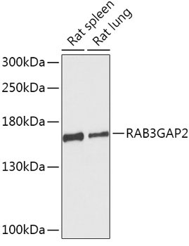 RAB3GAP2 Rabbit Polyclonal Antibody