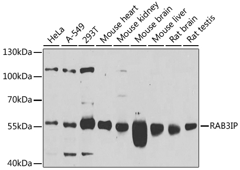 RAB3IP Rabbit Polyclonal Antibody