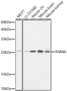 RAB4A Rabbit Monoclonal Antibody