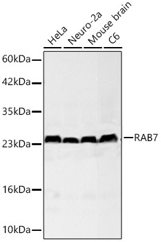 RAB7 Rabbit Monoclonal Antibody