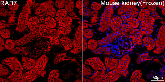 RAB7 Rabbit Monoclonal Antibody - Image 2