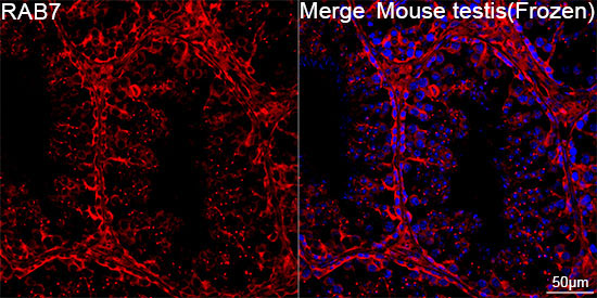 RAB7 Rabbit Monoclonal Antibody - Image 3