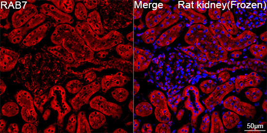 RAB7 Rabbit Monoclonal Antibody - Image 4